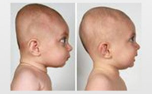 8 Helpful Tips To Prevent Flat Head In Babies
